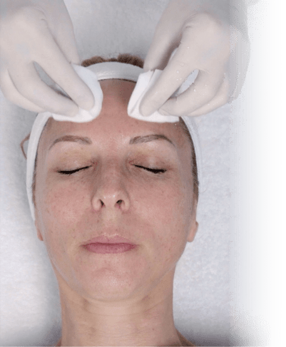 Peeling Eneomey Application Prepeel